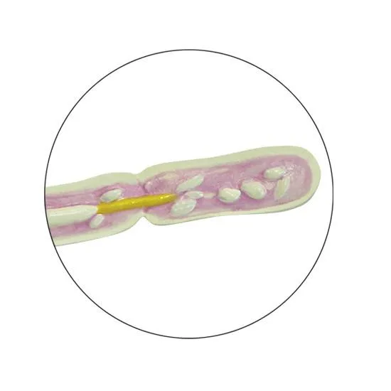 Type II Diabetes Set Model